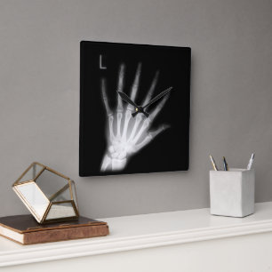 Extra Digit X-ray Left Hand Square Wall Clock