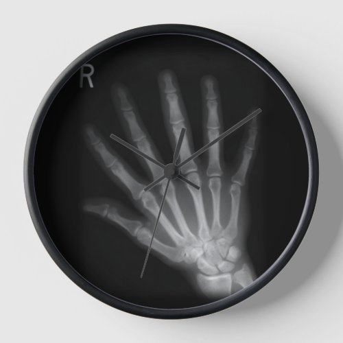 Extra Digit X_ray Richt Hand Clock