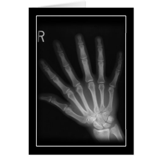 Extra Digit X-ray Right Hand Cards (Front)