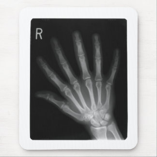 Extra Digit X-ray Right Hand Mouse Pad