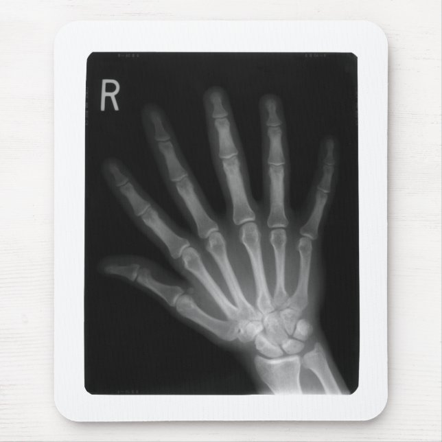 Extra Digit X-ray Right Hand Mouse Pad (Front)