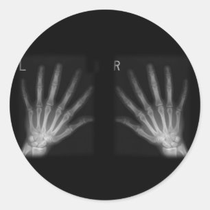 Extra Digit X-ray Right & Left Hands Classic Round Sticker