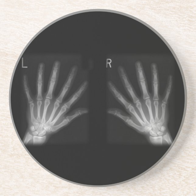 Extra Digit X-ray Right & Left Hands Drink Coaster (Front)