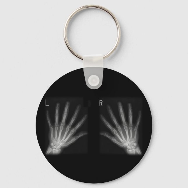 Extra Digit X-ray Right & Left Hands Keychain (Front)