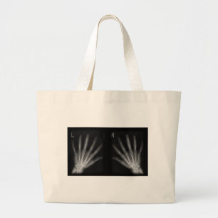 Extra Digit X-ray Right & Left Hands Large Tote Bag