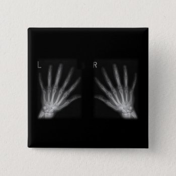 Extra Digit X-ray Right & Left Hands Pinback Button by gravityx9 at Zazzle