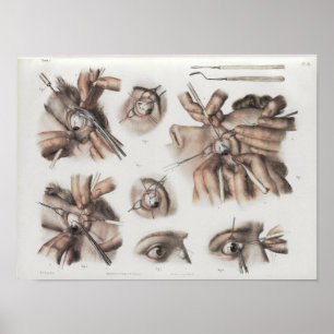 Eye Surgery Optometry Vintage Anatomy Print
