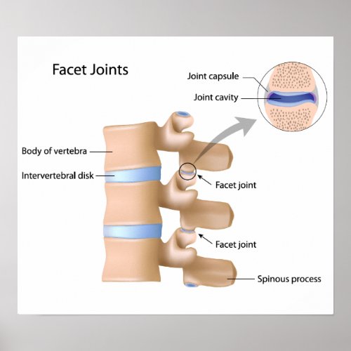 Facet joint Poster