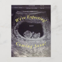 Fake, Prank Pregnancy