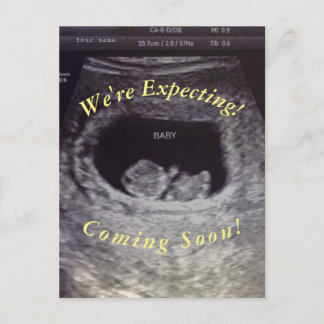 Fake, Prank Pregnancy Postcard