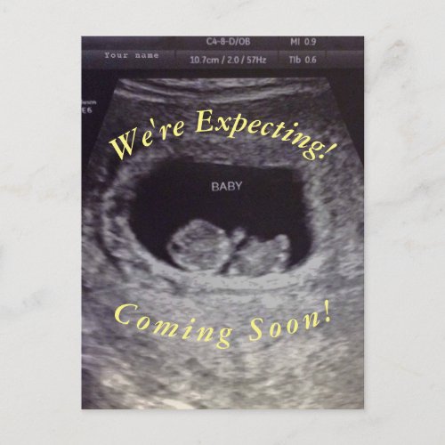 Fake Prank Pregnancy  Postcard