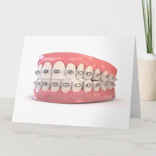 Fake Teeth Set With Braces Card