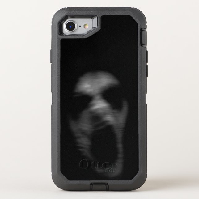 Falln Mental Disturbances Otterbox iPhone Case (Back)