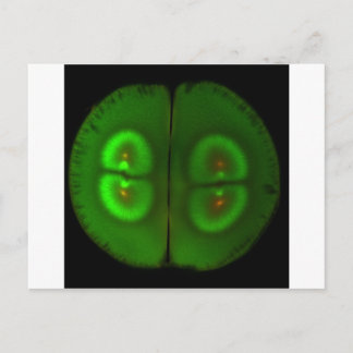 Fertilized frog egg postcard