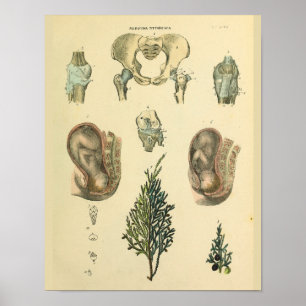 Fetal Position Pelvis Anatomy Vintage Art Print