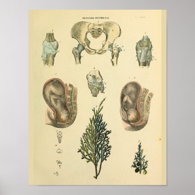 Fetal Position Pelvis Anatomy Vintage Art Print (Front)