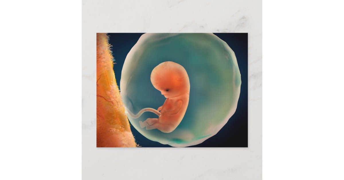 9 weeks fetus development