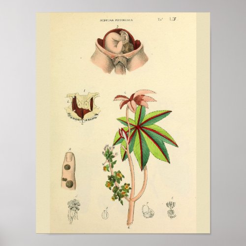 Fetus Position Uterus Vintage Anatomy Art Print