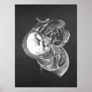 Fetus Womb Anatomy Obstetrics Decor no. 2