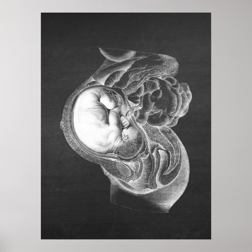 Fetus Womb Anatomy Obstetrics Decor no 2