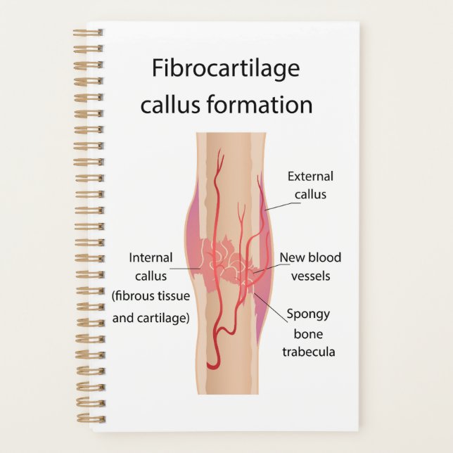 Fibrocartilage Callus formation Planner (Front)