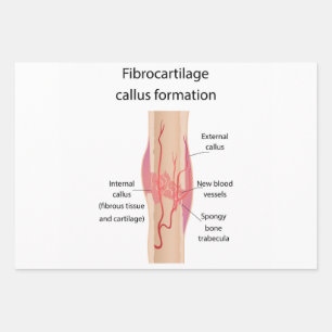 Fibrocartilage Callus formation Wrapping Paper Sheets