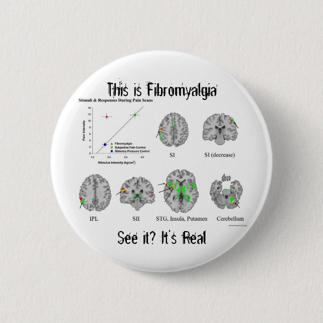 Fibromyalgia is real. fMRI proof Button (Front)