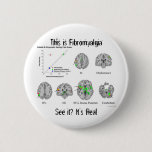 Fibromyalgia is real. fMRI proof Button