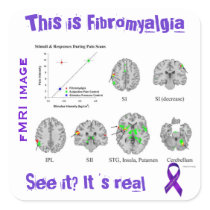 Fibromyalgia is real. You can see it on an fMRI Square Sticker