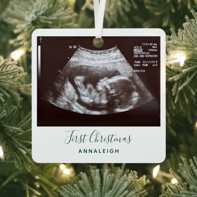 First Christmas Pregnancy Holiday Baby Scan Metal Ornament (Insitu)