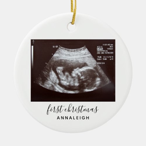 First Christmas Pregnancy Ultrasound Baby Scan Ceramic Ornament