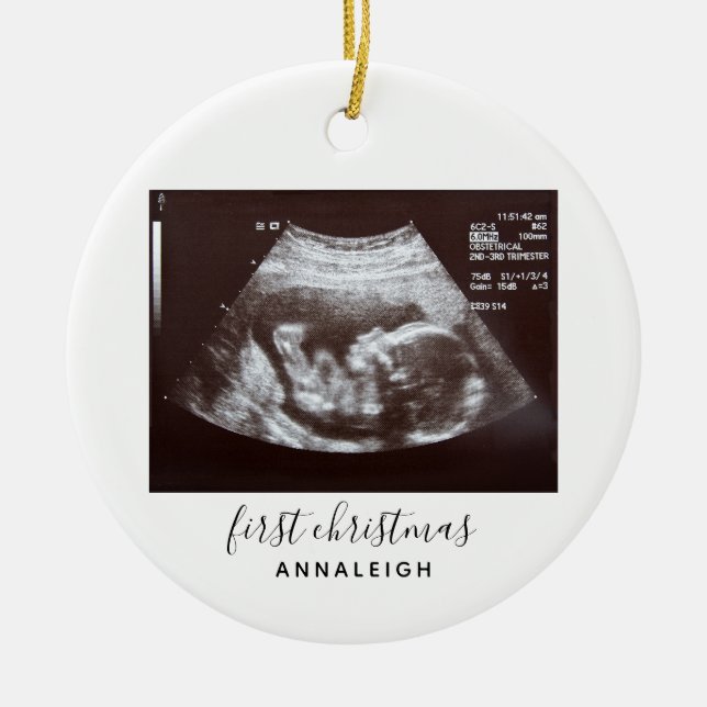 First Christmas Pregnancy Ultrasound Baby Scan Ceramic Ornament (Front)