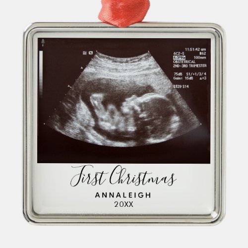 First Christmas Pregnancy Ultrasound Photo Custom Metal Ornament