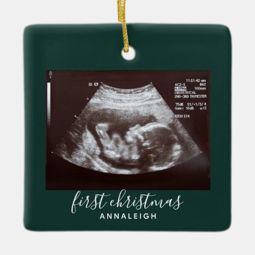 First Christmas Pregnancy Ultrasound Scan Custom Ceramic Ornament