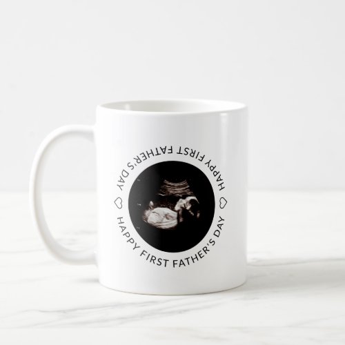 First Fathers Day Baby Sonogram Custom Name Photo Coffee Mug