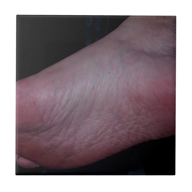 FOOT DOMME CERAMIC TILE (Front)