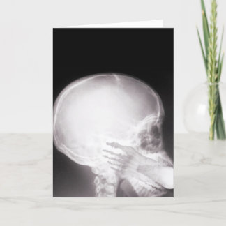 Foot in Mouth X-Ray Card