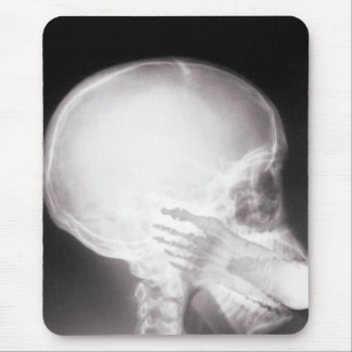 Foot in Mouth X-Ray Mouse Pad