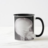 Foot in Mouth X-Ray Mug