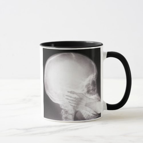 Foot in Mouth X_Ray Mug