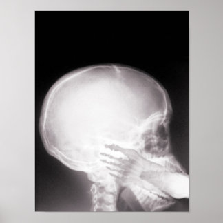 Foot in Mouth X-Ray Poster