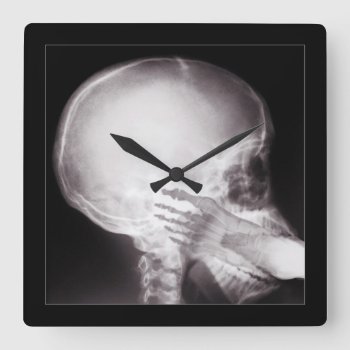 Foot In Mouth X-ray Square Wall Clock by gravityx9 at Zazzle