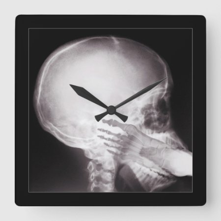Foot In Mouth X-ray Square Wall Clock