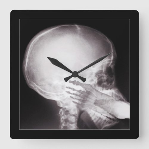 Foot in Mouth X_Ray Square Wall Clock