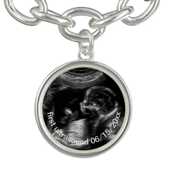 For New Mother First Ultrasound Sonogram Baby Bracelet (Design)