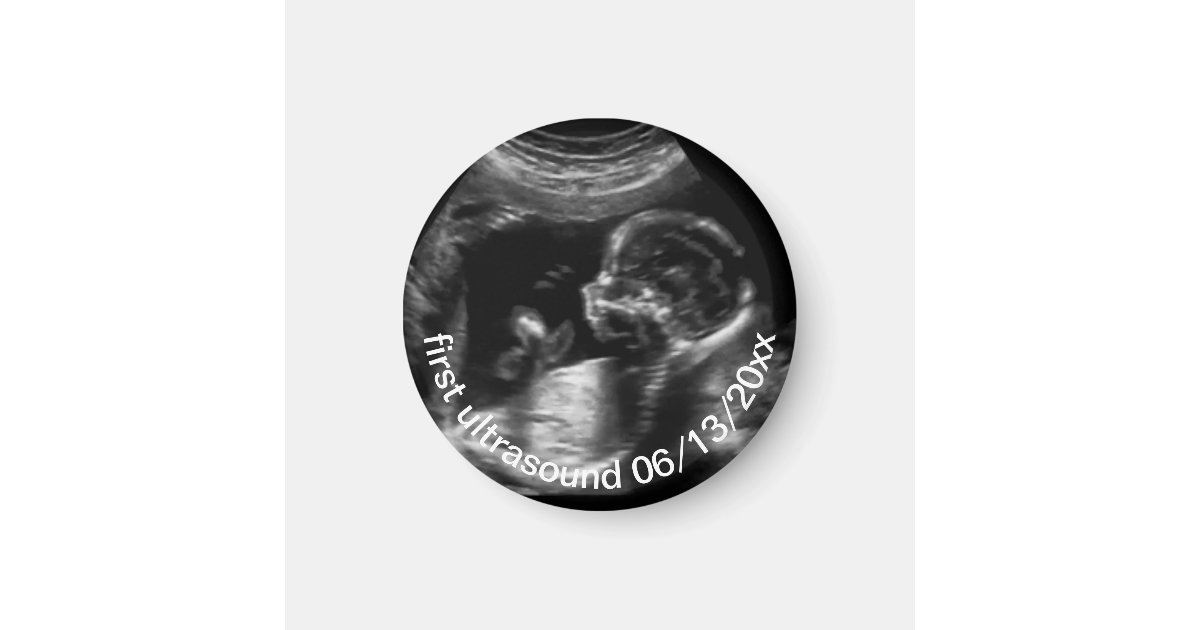 Sonogram Magnets For New Mother First Ultrasound Sonogram Baby Magnet | Zazzle