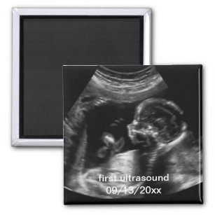 For New Mother First Ultrasound Sonogram Baby Magnet