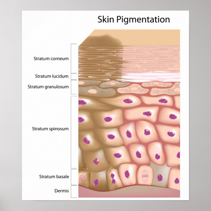 Formation of uneven skin tone Poster