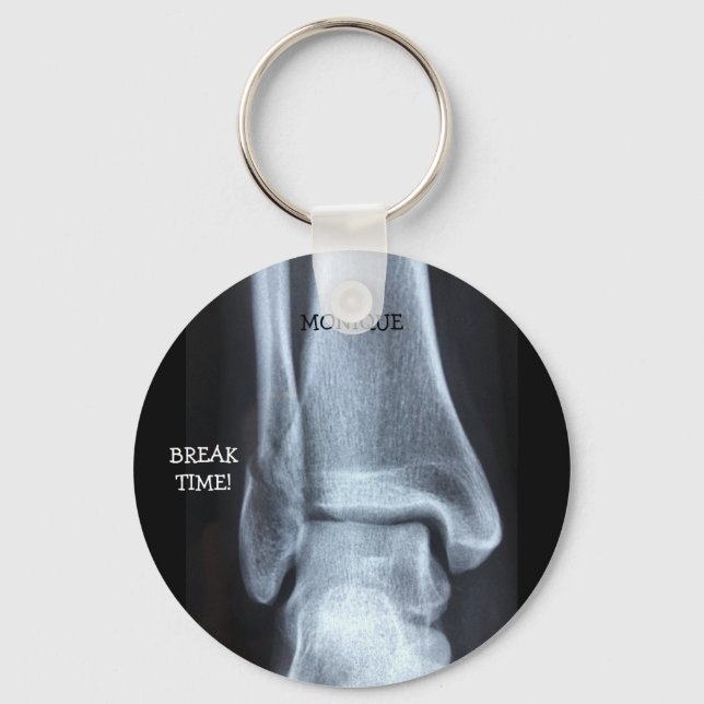 Funny Broken Fibula Xray "Break Time"    Keychain (Front)