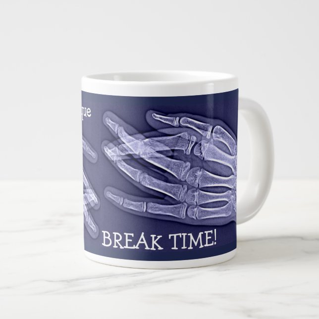 Funny Broken Finger Xray "Break Time" Giant Coffee Mug (Front Right)